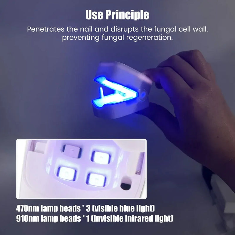 Dispositivo Profissional de Tratamento a Laser para Fungos nas Unhas - Máquina de Terapia para Unhas Quebradas, Rachadas e Fracas.